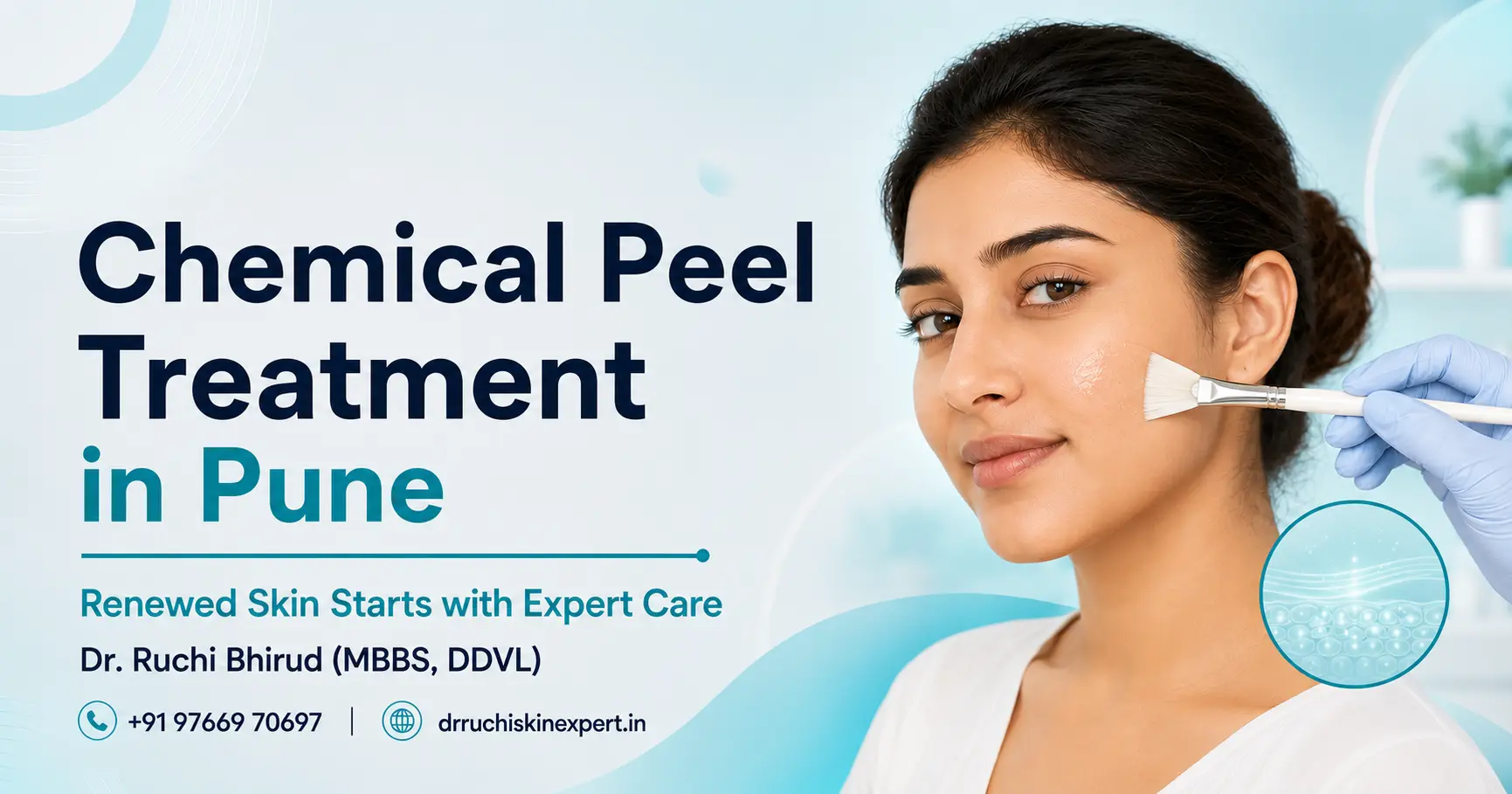 Chemical Peel Treatment in Pune banner featuring Dr. Ruchi Bhirud (MBBS, DDVL) skin specialist