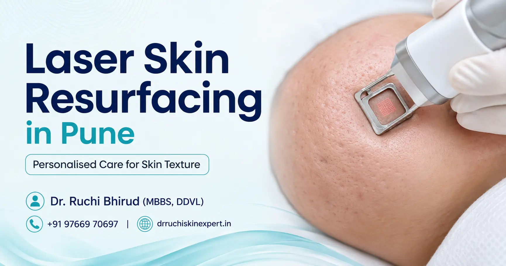 Laser Skin Resurfacing in Pune banner featuring Dr. Ruchi Bhirud (MBBS, DDVL) skin specialist